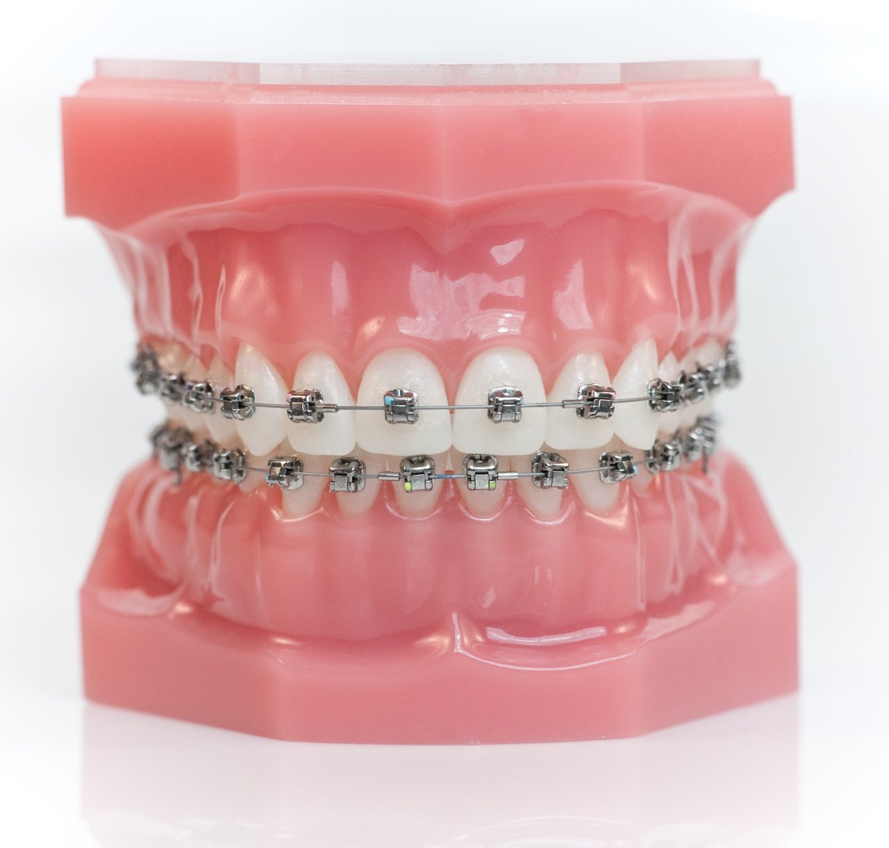Learn About Metal Braces At Kendrick Orthodontics Kissimmee