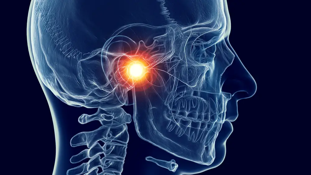 Transparent image of a person's head showing the lower jaw highlighted as its position can cause facial pain TMJ specialist like Dr. Kendrick can fix.