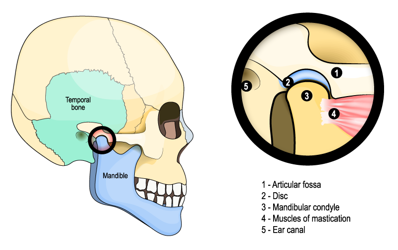 Skull illustration showing muscles in the cheek and temple area where the temporomandibular joint can be a source of extreme pain. TMJ is a specialty of Orthospaceship.