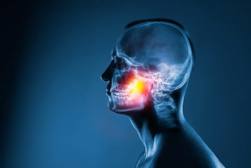 Dr. Kendrick, the best orthodontist in Kissimmee , holds a model showing the upper and lower jaw to simulate a patient's bite before jaw surgery and after jaw surgery