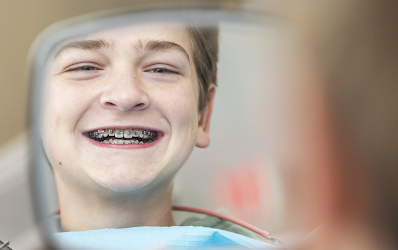 Customized Brackets for Your Needs
