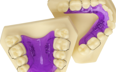 Palatal Expander Specialist  in Kissimmee, Florida
