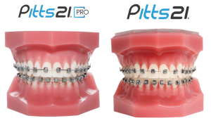 Pitts 21 self-ligating braces-low-profile brackets